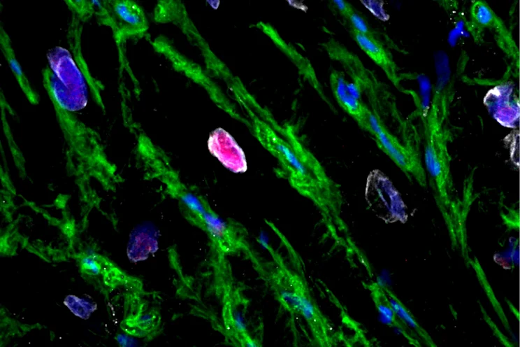 An image showing a cardiomyocyte regenerating. The pink is where antibodies added to the tissue sample by the researchers have clung to proteins that are expressed during mitosis. (Image credit: Robert Hume)