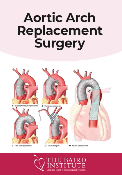 Fact Sheet - Aortic Arch Replacement Surgery