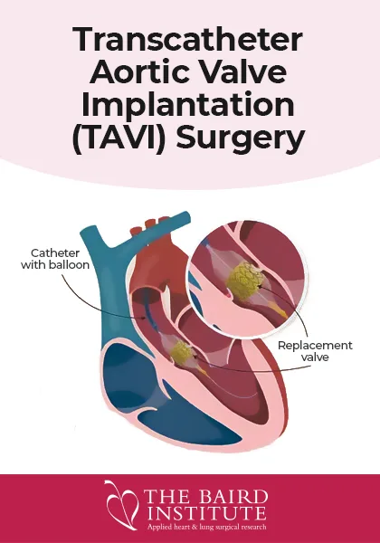 Fact Sheet - Transcatheter Aortic Valve Implantation (TAVI) Surgery