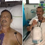 Patient Story - Dissection of the Aorta: Henry in hospital after surgery